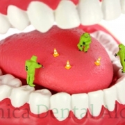 causas de la halitosis y como quitar el mal aliento
